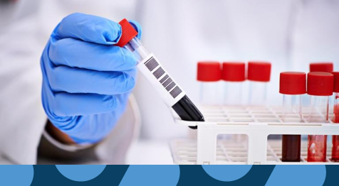 اسعار التحاليل الطبية في مصر | دليلك لمعرفة التكلفة